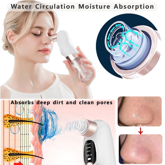 BXA Blackhead Remover Pore Vacuum | USB Rechargeable Water Cycle Face Cleaner