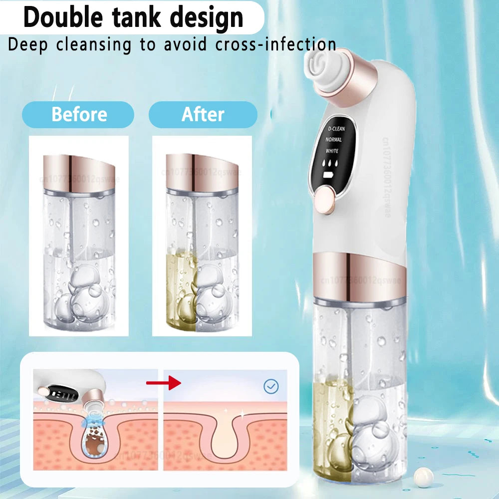 Bareskin Pore Vacuum Pro