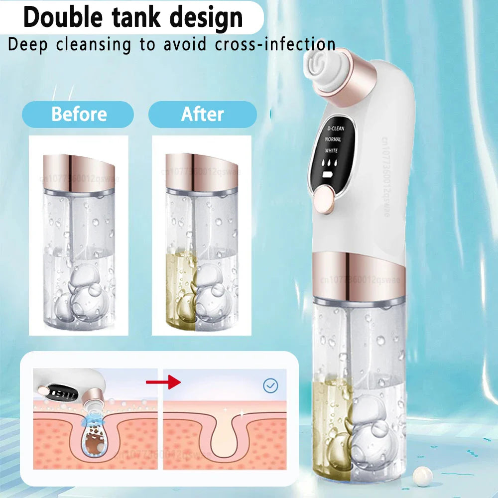 Bareskin Pore Vacuum Pro in use on nose and cheek area