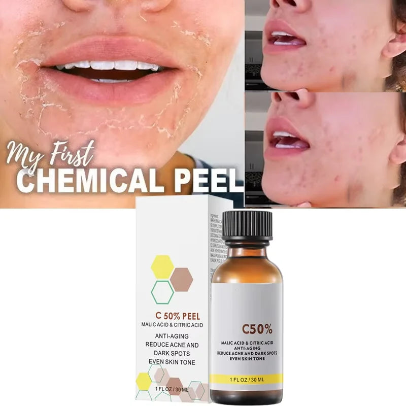 BARESKIN CO. CHEMICAL PEEL EXFOLIATING SERUM
