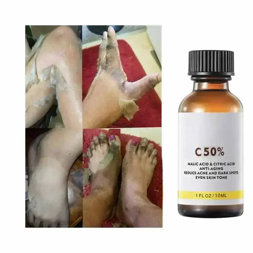 BARESKIN CO. CHEMICAL PEEL EXFOLIATING SERUM
