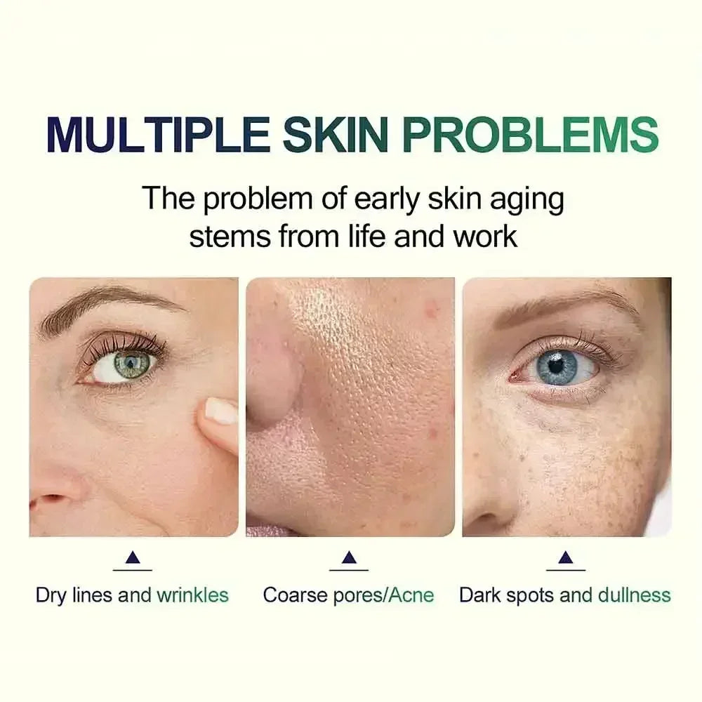 BARESKIN CO. CHEMICAL PEEL EXFOLIATING SERUM