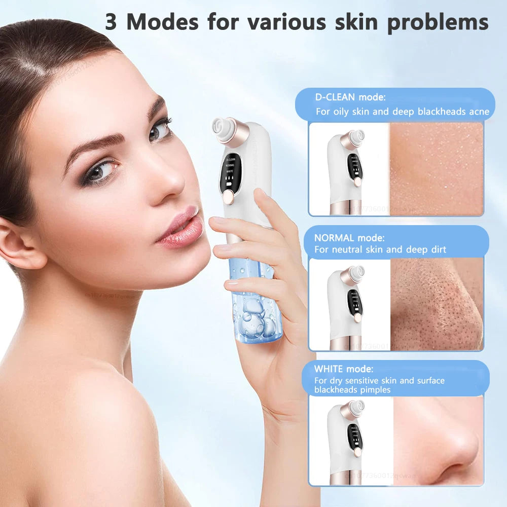Bareskin Pore Vacuum Pro