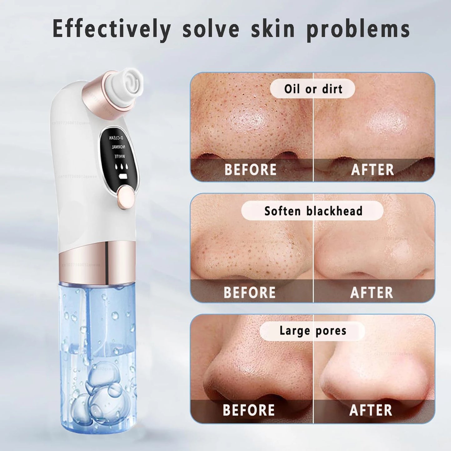 Bareskin Pore Vacuum Pro